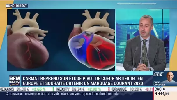 Stéphane Piat (Carmat): Carmat reprend son étude pivot de cœur artificiel en Europe