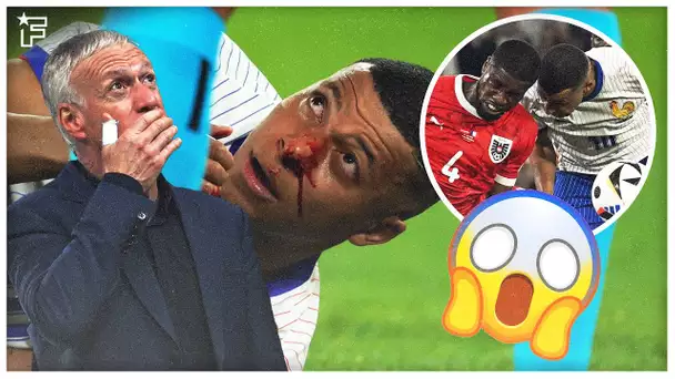 Nez FRACTURÉ pour Mbappé, les Bleus en PANIQUE | Revue de presse