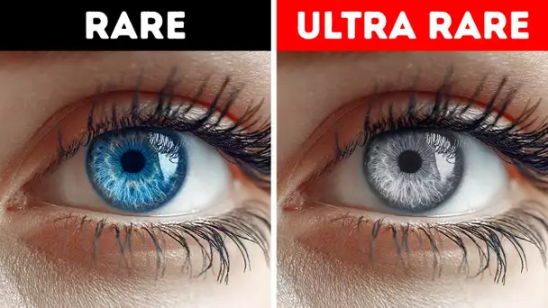 PODCAST : Pourquoi vous n'avez probablement jamais rencontré quelqu'un aux yeux gris