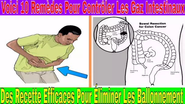 Voici 10 Remèdes Pour Contrôler Les Gaz Intestinaux Naturellement