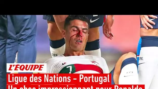 Ronaldo avec le nez en sang : les images de son choc impressionnant avec le gardien tchèque