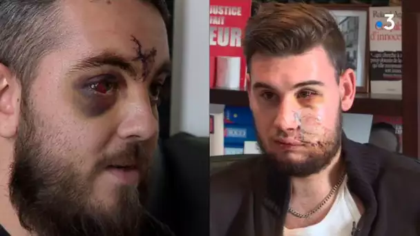 Montpellier : 3 ophtalmos pour un moratoire sur l&#039;usage des LBD