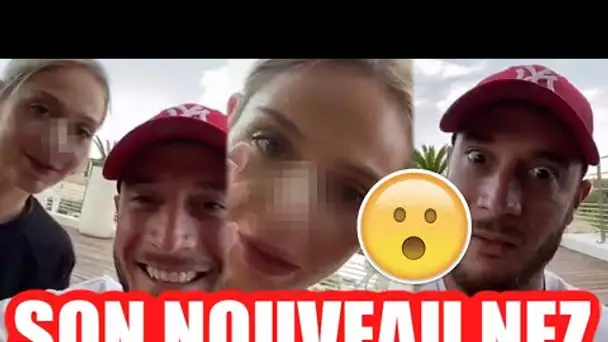 ELOISE RÉVÈLE ENFIN SON TOUT NOUVEAU NEZ AVEC SON CHÉRI NACCA ! 😮 ILS SONT ULTRA CONTENTS !!