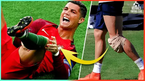La blessure qui a changé le jeu de Cristiano Ronaldo à jamais