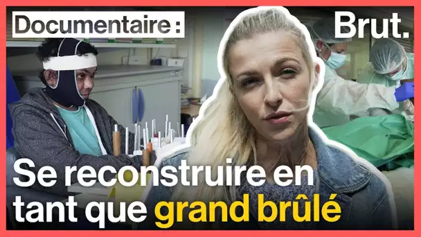 Julie Bourges retrace le parcours d&#039;un grand brûlé