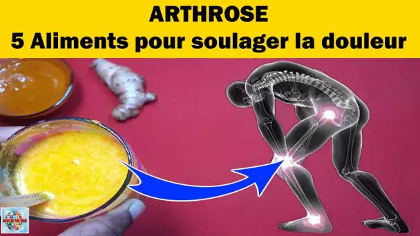 Arthrose - 5 Aliments pour soulager la douleur #shorts