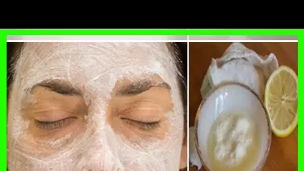 Appliquez ce masque au bicarbonate de soude et au citron sur votre visage et quelque chose d’incroy