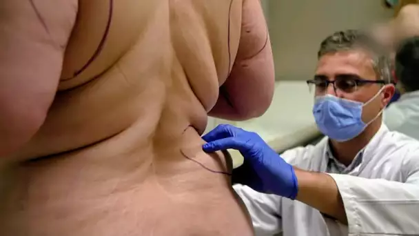 France ou Turquie ? La chirurgie esthétique en plein boom