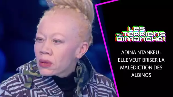 Adine Ntankeu : Elle veut briser la malédiction des albinos - LTD 17/02/2019