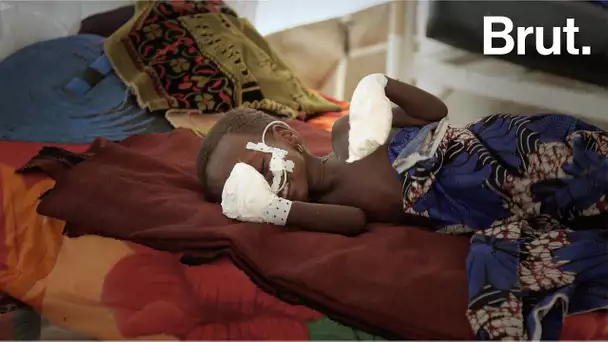 Dans un hôpital d&#039;urgence du Tchad avec les équipes de MSF