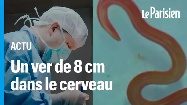 Des chirurgiens ont retiré un ver de 8 cm de son cerveau