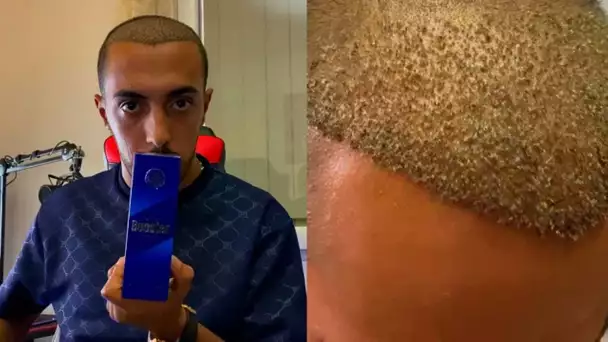 OMG !!! Enfin UN TRÈS GROS CHANGEMENT sur ma GREFFE CAPILLAIRE