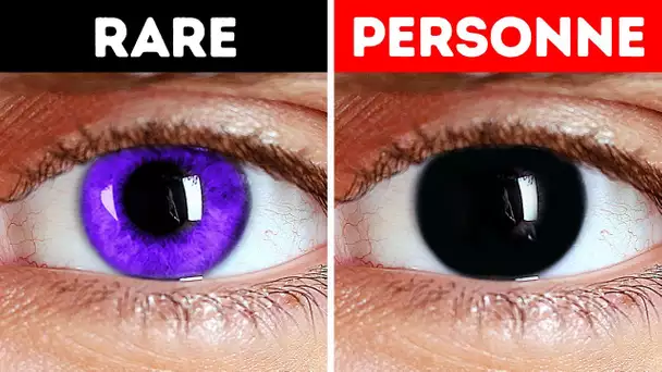 Pourquoi les gens ne naissent pas avec des yeux noirs ?