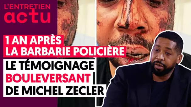1 AN APRÈS LA BARBARIE POLICIÈRE : LE TÉMOIGNAGE BOULEVERSANT DE MICHEL ZECLER