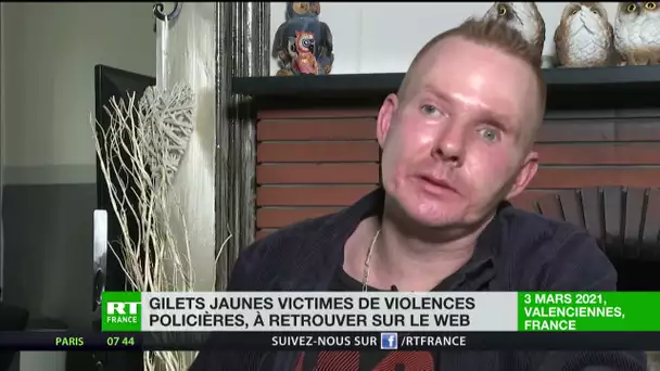 Gilets jaunes victimes de violences policières : Manu Coisne
