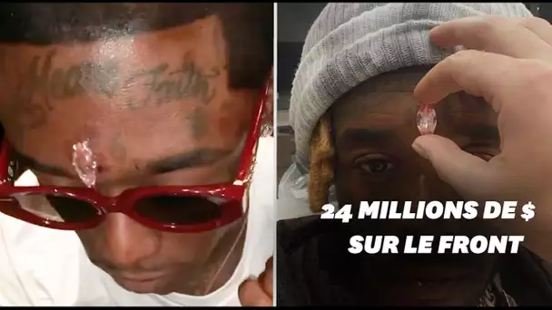 Le rappeur Lil Uzi Vert s'est fait implanter un diamant de 11 carats sur le front