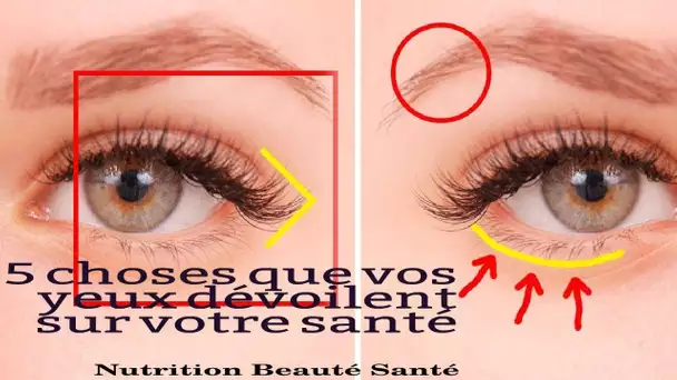 Voici 5 Problemes Santé Que Vos Yeux Dévoilent   Et Voici Leur Solution Natutelle