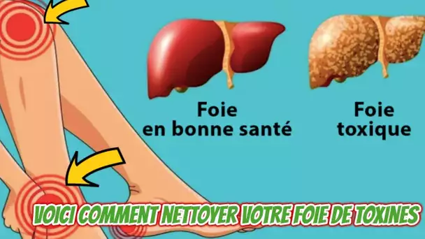 Voici comment nettoyer votre foie de toxines et perdre du poids en 72h grâce au citron