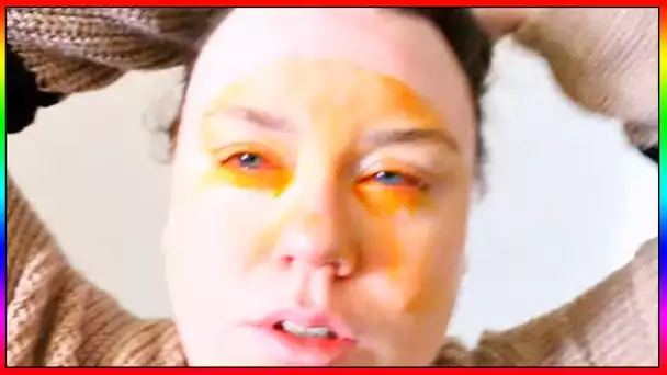 OBLIGÉ DE PARTIR AU MÉDECIN D'URGENCE - LIA A LES YEUX QUI LA BRÛLE COMPLÈTEMENT !