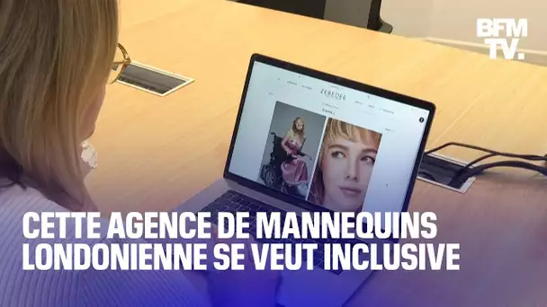 Handicap physique ou mental, vitiligo ou albinisme… Cette agence de mannequin se veut inclusive