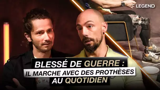 Blessé de guerre : Il marche avec des prothèses au quotidien