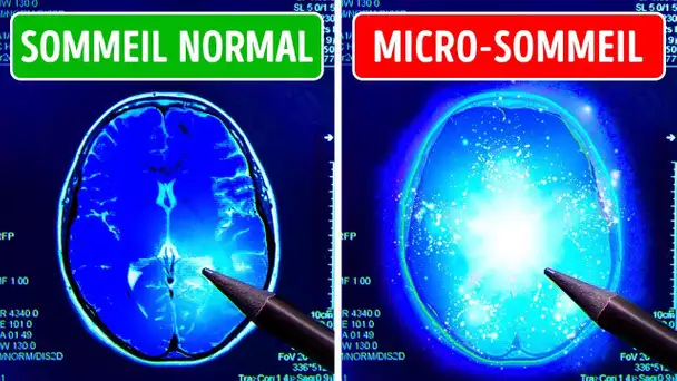 Ton Cerveau Dort Parfois Sans Que tu le Saches