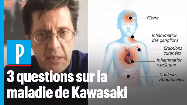 Syndrome de Kawasaki et Covid-19: "Une forte fièvre et des problèmes digestifs au premier plan"