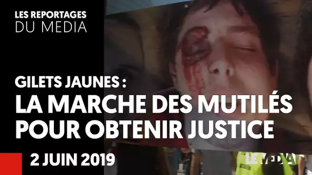 GILETS JAUNES : LA MARCHE DES MUTILÉS POUR OBTENIR JUSTICE