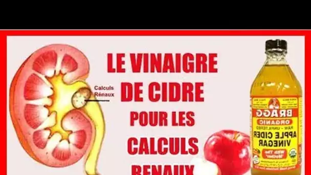 Nouvelle révélation sur le vinaigre à cidre : Efficace contre les calculs rénaux et voici comment l