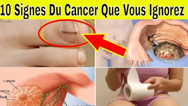 10 premiers signes que le cancer se développe à l&#039;intérieur de votre corps! Ne pas ignorer! 😱
