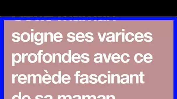 Cette maman soigne ses varices profondes avec ce remède fascinant de sa maman … Une astuce de Grand