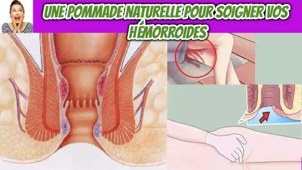 Une pommade naturelle à la camomille et les pétales de rose pour soigner vos hémorroïdes