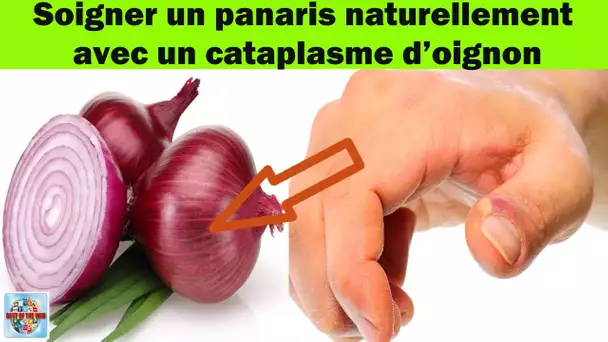 Comment soigner un panaris naturellement avec un cataplasme à base d’oignon