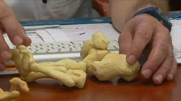Dossier santé : des os réalisés grâce à une imprimante 3D à Limoges