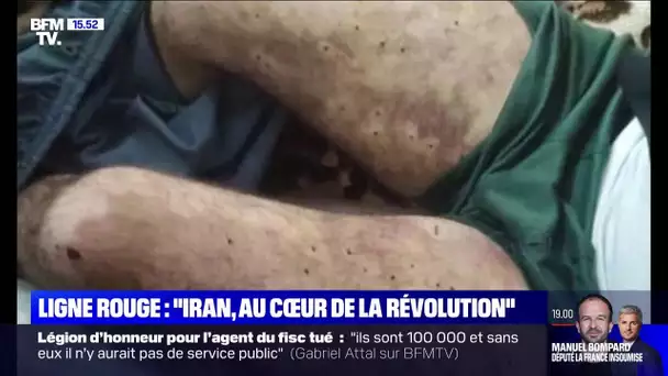 LIGNE ROUGE -Cet homme a reçu plus de 200 balles de plomb dans le corps pour avoir manifesté en Iran