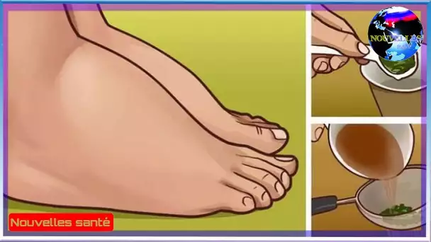 Le traitement de vos chevilles et de vos pieds est naturellement gonflé.