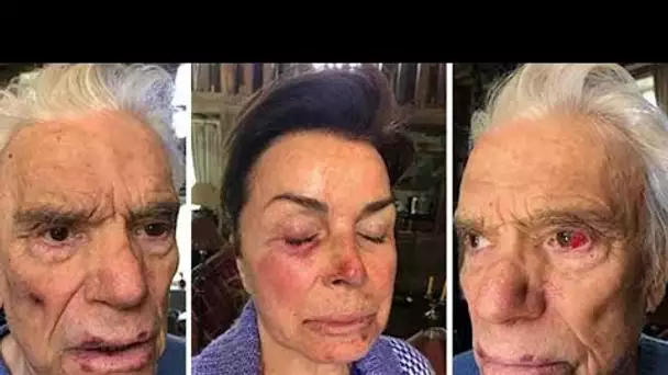 Bernard Tapie : tabassé, ligoté avec sa femme en pleine nuit par 4 cambrioleurs, les détails dévoi