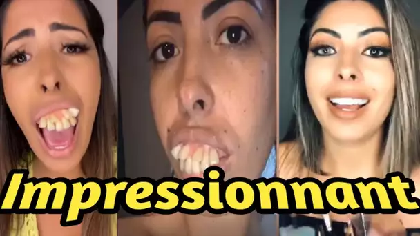 Elle montre la transformation de ses dents : les internautes sont choqués