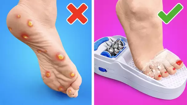 GADGETS ET ASTUCES UTILES POUR LES PIEDS || INCROYABLE TRANSFORMATION AVEC UNE PÉDICURE