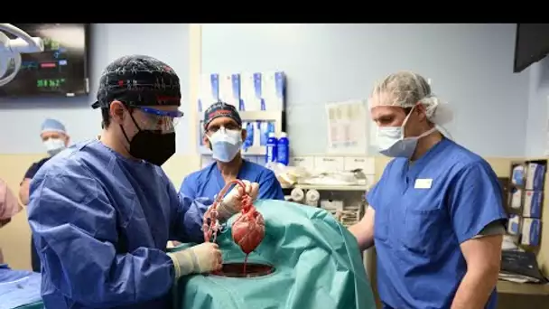 États-Unis : des chirurgiens ont greffé avec succès le coeur d'un porc sur un homme
