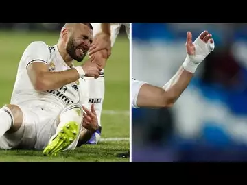 L’étonnante blessure au doigt de Karim Benzema, renversante torsion