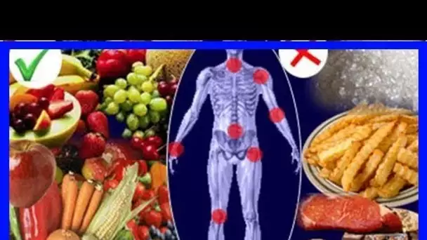 ARTHROSE ET ALIMENTATION