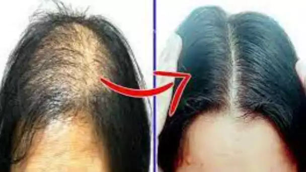 You will thank with this natural recipe to grow hair fast!