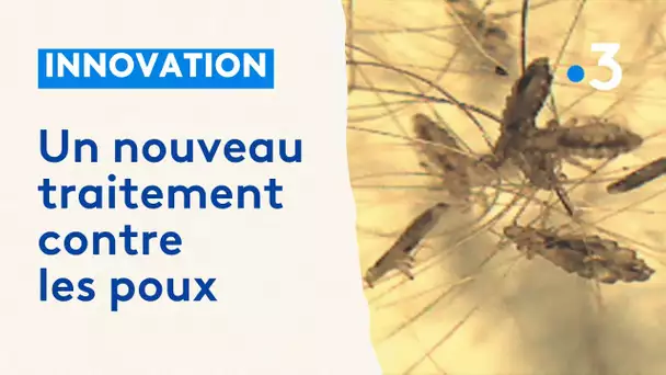 Pour lutter contre les poux, un lillois a conçu une lotion à base de résine originaire d'Amazonie