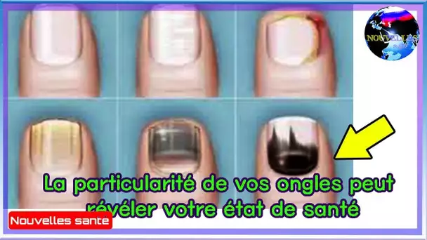 La particularité de vos ongles peut révéler votre état de santé