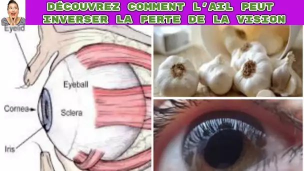 Comment utiliser l'ail pressé pour inverser la perte vue, sans lunettes ni chirurgie.