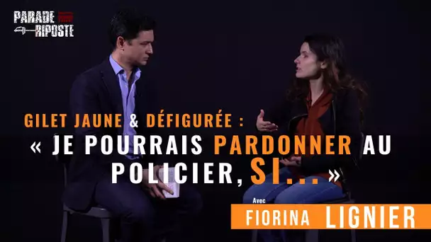 Fiorina Lignier, Gilet jaune & défigurée : « je pourrais pardonner au policier, si… »
