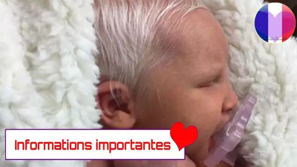 Voici comment ce bébé est né avec les cheveux blancs !