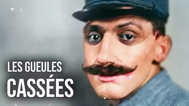 L’histoire tragique des « Gueules Cassées », martyrs de la Grande Guerre - HDG #59