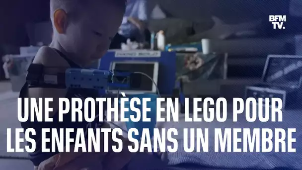 Une prothèse en lego pour aider les enfants nés sans un membre